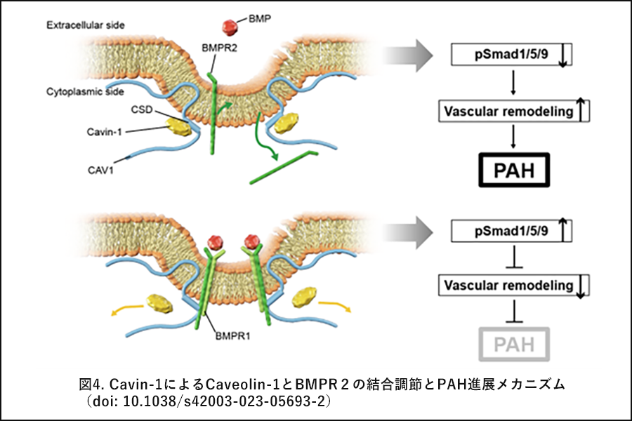 図4. Cavin-1によるCaveolin-1とBMPR２の結合調節とPAH進展メカニズム