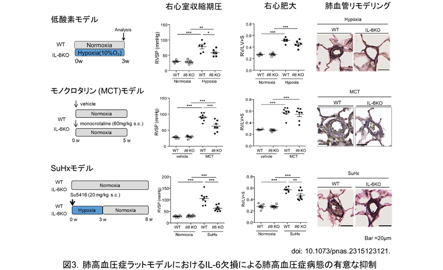 図3.肺高血圧症ラットモデルにおけるIL-6欠損による肺高血圧症病態の有意な抑制